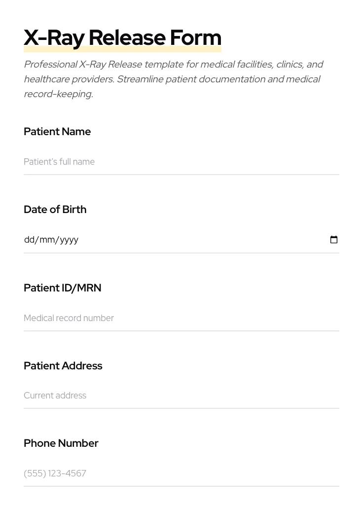 X-Ray Release preview